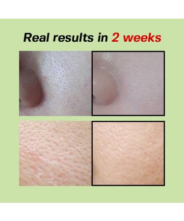 SUNGBOON EDITOR Green Tomato Pore Lifting Ampoule | Pore Minimizer Serum with Niacinamide & Green Tomato Extract | Hydrating & Firming Care for Sensitive Skin | Korean Skincare - Buy Online on GoSupps.com