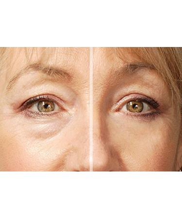 Rox Flawless Eyes by RX | Premium Eye Care for Radiant Skin | Shop Internationally Now - Buy Online on GoSupps.com
