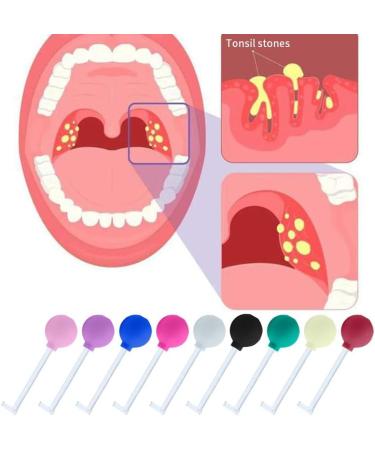 Tonsil Stone Remover Tool - Manual Cleaner for Fresh Breath & Bad Breath Relief | Almond Sucker Tonsillenstein Removal - Shop Now! - Buy Online on GoSupps.com