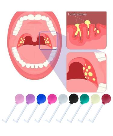Tonsil Stone Remove Tool Manual Style Cleaner Removal Mouth Cleaning Oral Care Mouth Cleaner for Adults Tonsil Stone Remover Tool for Removing Tonsils Cupping Tool for Tonsil Stones (RED)