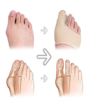 Bunion Corrector Splints 1 Pair - Toe Straightener & Separator for Pain Relief | Maeeli Toe Valgus Care Protector - Buy Online on GoSupps.com