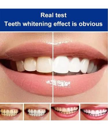 3Pcs Yayashi SP-4 Fresh Breath Stain Removing Toothpaste (White) - Buy Online on GoSupps.com