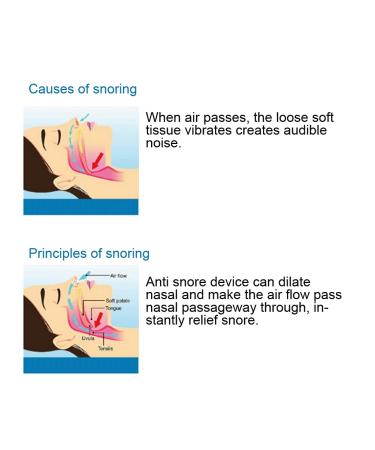 Anti-Snore Nose Purifier - Stop Snoring Aid Stopper Device (Blue) - Buy Online on GoSupps.com