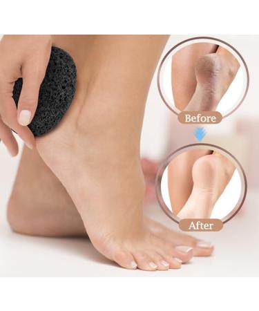 Black Pumice Stone Scrubber - Natural Lava Stone for Callus Removal Foot & Hand Exfoliation Healthy Skin Care Tool - Buy Online on GoSupps.com