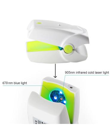 Nail Fungus Cleaning Device - Safe, Quick & Painless Solution for Fingernails and Toenails Fungus - Buy Online on GoSupps.com