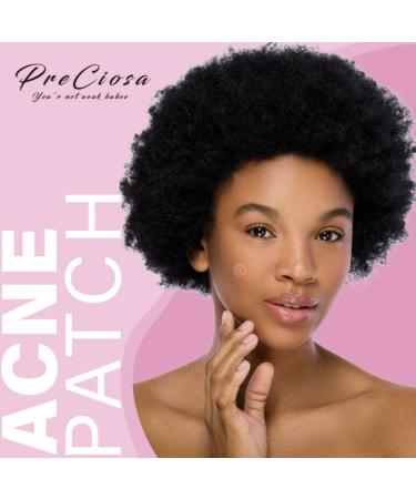 Buy Hydrocolloid Acne Pimple Patches (72 Pcs) | Invisible Acne Treatment - Fast International Shipping - Buy Online on GoSupps.com