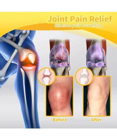 Bee V-enom P-ain-Relief Bone Care CreamS Professional Bee V-enom Ointment BEE V-enom Joint Relief Moisture C-ream Bee V-nom Pain-Relief Bone Healing Cream (1 pcs) - Buy Online on GoSupps.com