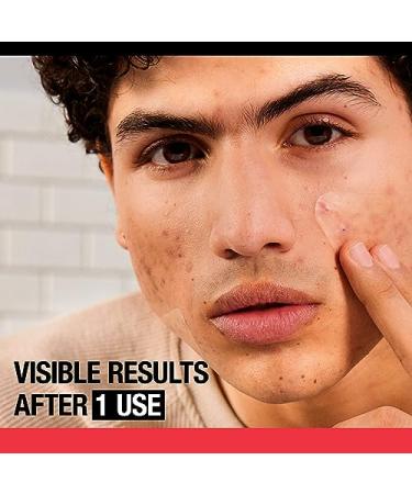 Stubborn Acne Pimple Patches - Invisible Hydrocolloid Face Patch for Redness Reduction | 10ct with Nose Cleaning Brush - Day & Night Solution - Buy Online on GoSupps.com