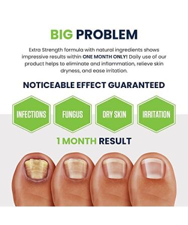 Extra Strength Toenail Fungus Treatment Kit - Foot Soak, Nail Repair Pen, Tea Tree Balm - Made in USA - Effective Solution for Smelly Feet, Athletes Foot, Cracked Nails - Buy Online on GoSupps.com