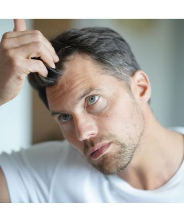 Anagain Hair & Beard Growth Serum - Advanced Biotin & Castor Oil Formula for Thicker Fuller Hair Regrowth - 60 mL - Buy Online on GoSupps.com