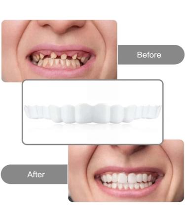 2 Pairs Snap-in Veneer Dentures for Men and Women - Instant Confidence Smile - Buy Online on GoSupps.com
