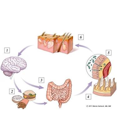 Clear-Biotic Acne Treatment Supplements Probiotic Pills for Teens & Adults | Hormonal Acne Vitamins Gut Health Support Clear Skin Formula Acne Vitamins Non-GMO (60 Capsules) - Buy Online on GoSupps.com