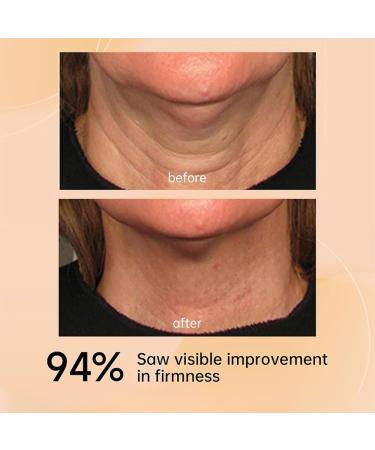 KlsyChry AH8 Firming Neck Cream Firms and Lifts Neck Cream with Double Roller Massage Roller Neck Cream Reduces Wrinkles Fine Lines and Double Chin Firms and Lifts Sagging Skin 120g423oz - Buy Online on GoSupps.com