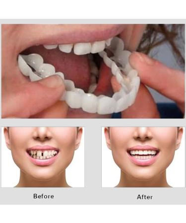 Snap On Veneers for Men & Women | Moldable False Teeth & Denture Replacement Kit with Teeth Grinding Guard & Whitening Strips - Buy Online on GoSupps.com