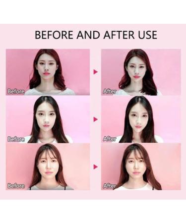 Hydrocolloid Face Lift Tape for All Skin Types | Instant V-Shaped Lift & Double Chin Solution - Buy Online on GoSupps.com