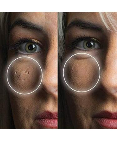 Dermaflage Acne Scar Filler & Concealer Fair | 1 Month Supply | Scar Makeup - Buy Online on GoSupps.com