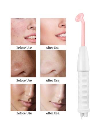4 in 1 Multifunction High Frequency Electrotherapy Device | Acne Treatment & Facial Care Spa Tool International Shipping Available (EU) - Buy Online on GoSupps.com