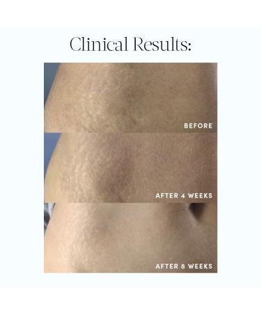 Evereden Golden Belly Serum 1.7 fl oz. & Nourishing Stretch Mark Cream 4.0 fl oz. | 2 Item Bundle Set | Maternity Skincare - Buy Online on GoSupps.com