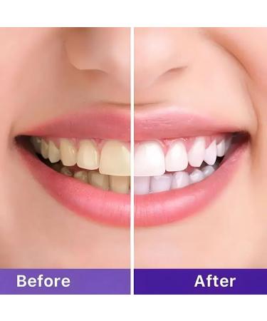 10-in-1 Teeth Whitening Kit with LED Light | Color Corrector Gel Tubes & Strips - Ultimate Smile Upgrade - Buy Online on GoSupps.com