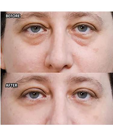 Wow-IT Instant Under Eye Cream: Instantly Remove Eye Bags - Anti-Wrinkle Eye Cream (3 pcs) - Buy Online on GoSupps.com