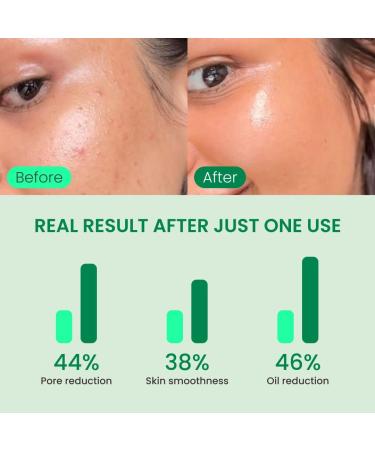 QUIA Korean Skincare Duo - Toner Pads + Collagen Jelly Cream - Lightweight Daily Hydration System - Refine Texture Plump & Firm Appearance - Non-Greasy Gel Moisturizer for Glowing Skin - Buy Online on GoSupps.com