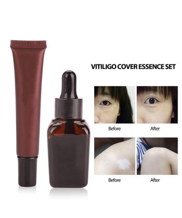 Salmue Tattoo Concealer Cream Set | Professional Vitiligo Essence Makeup Camouflage Cream - Buy Online on GoSupps.com
