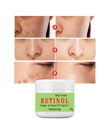 BEROZA Cremas Para Las Manchas de La Cara 50g Cremas para quitar manchas de la cara Vitamin C&E Face Moisturizer Cream Crema para manchas oscuras en la piel (2pcs) - Buy Online on GoSupps.com