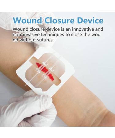 Smerphox Wound Closure Strip - Sterile First Aid Band Kit for Emergency Wound Care - Suture-Free Adhesive Stitch Device - 6pcs - Buy Online on GoSupps.com