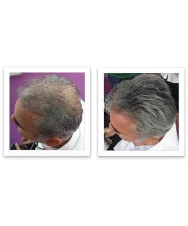 Caboki VALUE PACK 2 (3 x 30 gram plus one Volume Control Mist) 270-Day Supply Salt & Pepper Light - Buy Online on GoSupps.com