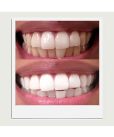 Expertwhite Professional Teeth Whitening Pen for Daily Maintenance & Stain Touch-Ups Neutral pH No Sensitivity Dentist-Grade Formula - Buy Online on GoSupps.com