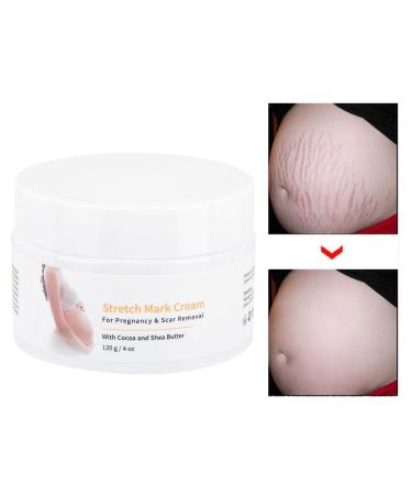 Stretch Stripes Cream 120g | Remove Stretch Marks Pregnancy Scars & Acne | Maternity Repair Treatment - Buy Online on GoSupps.com