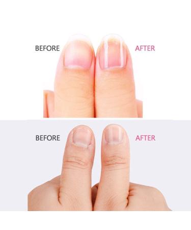 12 Professional Buffer Blocks for Natural Nails - Nail File Grit 150 for Gel & Beauty Salons | International Shipping - Buy Online on GoSupps.com