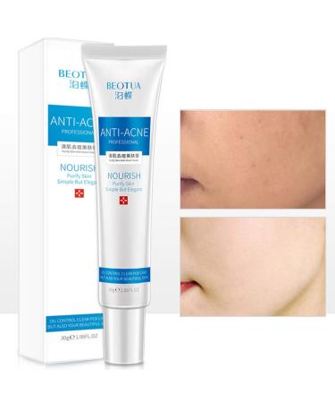 Removal Mark Pimple Pro Blemish Scar Spots Ointment for Glass Skin - White One Size - Buy Online on GoSupps.com
