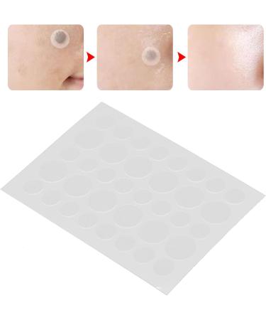Skin Tag Cover Patch 36 Patches Skin Tag Cover Patches Mole Acne Pimple Covers Concealing Patch Sticker Pimple Cover Patch Mole Concealing Patch - Buy Online on GoSupps.com