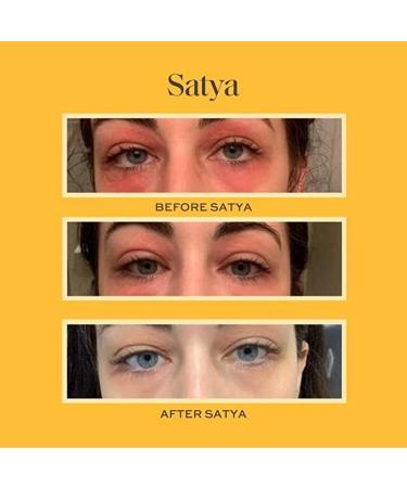 Satya Organic Eczema Balm Stick - 1 oz Full Body Treatment for Adults & Kids - Buy Online on GoSupps.com