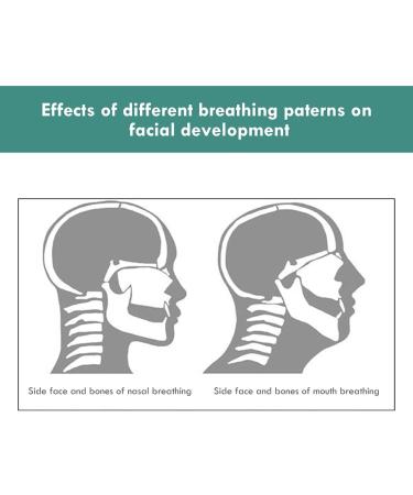 Sleep Strips: Nasal Breathing Anti Snoring Tapes - 90 Pieces - Buy Online on GoSupps.com