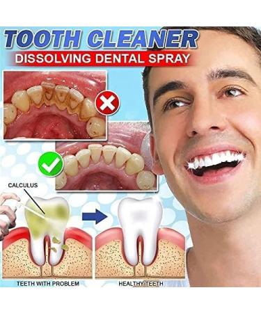 Buy Calculus-Free Soluble Tooth Spray | Mouth Freshener & Intensive Stain Remover - 2 Pieces | Dental Care Solution - Buy Online on GoSupps.com