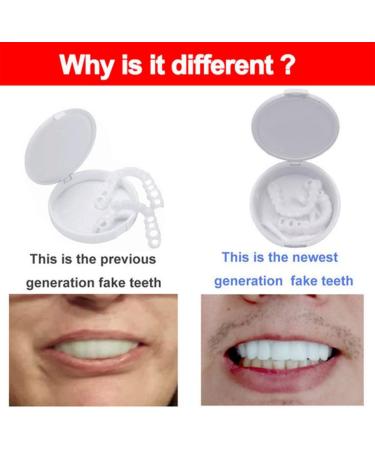 Xzlzmd Pebbles Dentures | Cosmetic Artificial Teeth Veneers - Reusable Upper & Lower Teeth Prosthesis | Perfect Smile | 3 Pairs - Buy Online on GoSupps.com