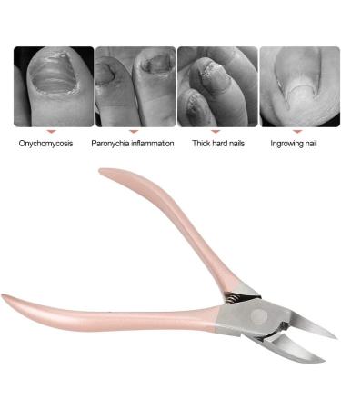 Professional Stainless Steel Nail Clipper Cutter for Thick Hard Nails Onychomycosis Paronychia with Mortise and Tenon Joint Structure Rose Gold Color (-1414200004111) YUYTEmcvdxeu2yh-11 - Buy Online on GoSupps.com