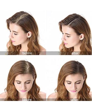 Purc Hair Growth Oil - Fast Hair Growth & Scalp Treatment for Men & Women | Prevent Hair Loss | 20ml - Buy Online on GoSupps.com