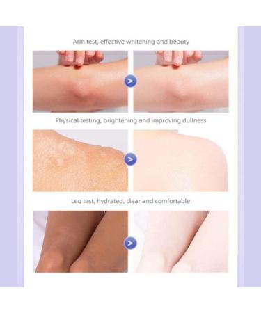 Yinba Incubation Whitening Cream Japanese Skin Whitening Body Lotion with Spf Cold White Skin All Over Body Cold White Whole Body Whitening Cream Cream Dec - Buy Online on GoSupps.com