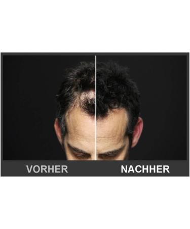 Church Dwight TOPPIK 55 g hair fibers hair densification straw hair dark brown - Buy Online on GoSupps.com