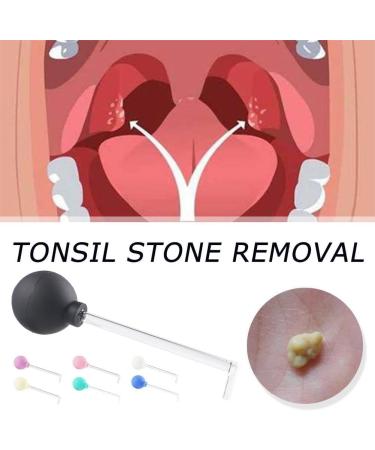 Right-Angled Long Pipe Glass Cleaning Tool - PVC Suction Ball Manual for Teeth Clamp Cleaner - Tonsillenstein Goods - Buy Online on GoSupps.com
