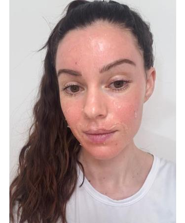 Jessner Solution Acid Peel 50% 1oz. 30ml (Level 2 pH 1.9) - Exfoliating (FREE Neutralizer 100ml) - Buy Online on GoSupps.com