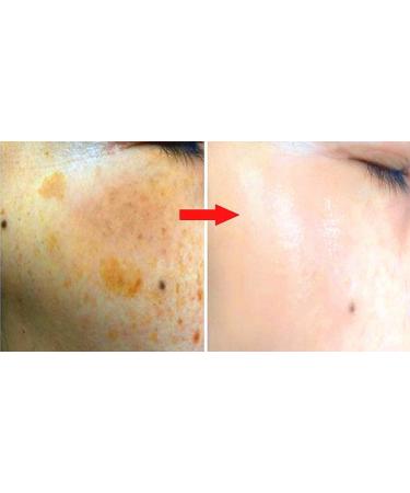WHITESILK THE SCM 85 (human stem cell) Therapy Cream Ageless Skin with (5%) volufiline + ATP + Retinal for Face/Neck/Cleavage (50ml / 1.69oz) - Buy Online on GoSupps.com