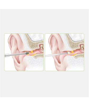 ZYZMH Spiral Ear Pick Wax Remover Cleaner - Silicone & Stainless Steel Ear Cleaning Tool - Buy Online on GoSupps.com