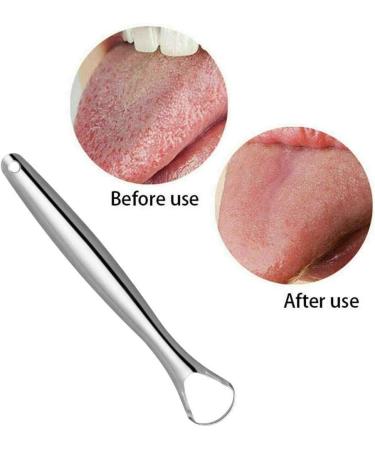 ZXCVWWE U Type Stainless Steel Tongue Scraper - Premium Tongue Cleaner Brush for Improved Oral Hygiene & Fresh Breath - Respiratory Care Tool - Buy Online on GoSupps.com