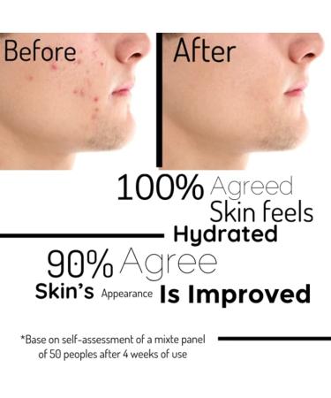 La p Paris Hazelnut Foaming Facial Cleanser | Moisturize & Hydrate All Skin Types | International Shipping Available - Buy Online on GoSupps.com