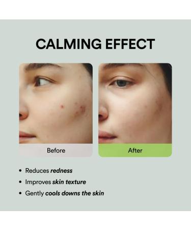 Abib Soothing Acne Care Duo: Heartleaf Teca Capsule Serum Calming Drop & Heartleaf Spot Pad Calming Touch 80pads I Centella Asiatica & Niacinamide Serum Toner Pads for Sensitive Skin - Buy Online on GoSupps.com