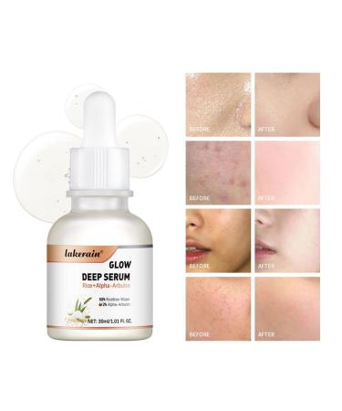 Rice + Alpha-Arbutin Glow Deep Serum - Hydrating Facial Serum for Dullness & Dark Spots 30ml | All Skin Types - Buy Online on GoSupps.com